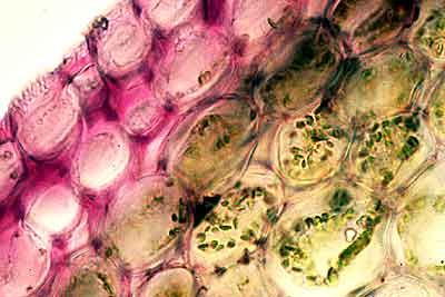 parenchyma_photo parenchyma_photo