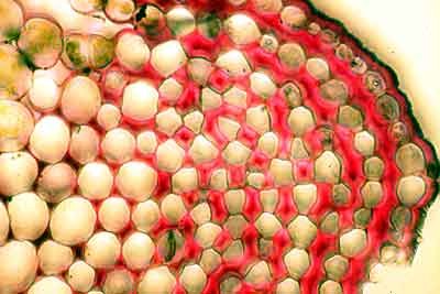 collenchyma_cs collenchyma_cs