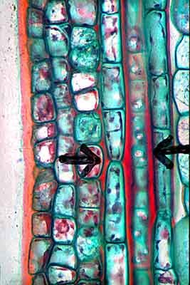 collenchyma_ls collenchyma_ls