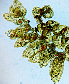 leptolejeunea_ellip (600)1702Mic-1