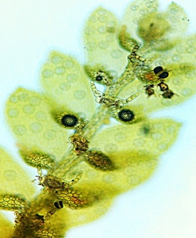 leptolejeunea_ellip ventral (600)1702Mic-7