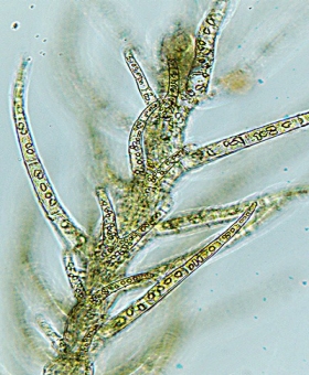 telaranea_herz(ventral) I1686-Scope-13