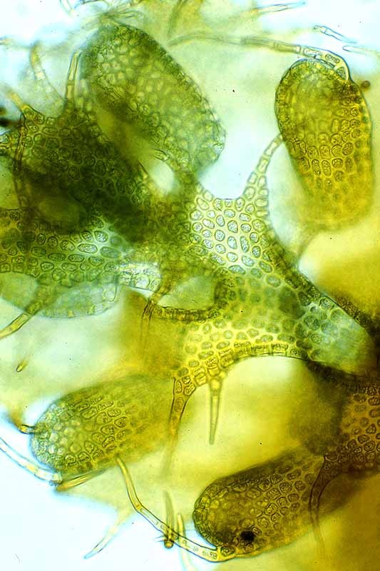 Gackstroemia sp. aff. weindorferi - The cellular detail of the lobules and cilia are clearly shown Gackstroemia sp. aff. weindorferi - The cellular detail of the lobules and cilia are clearly shown
