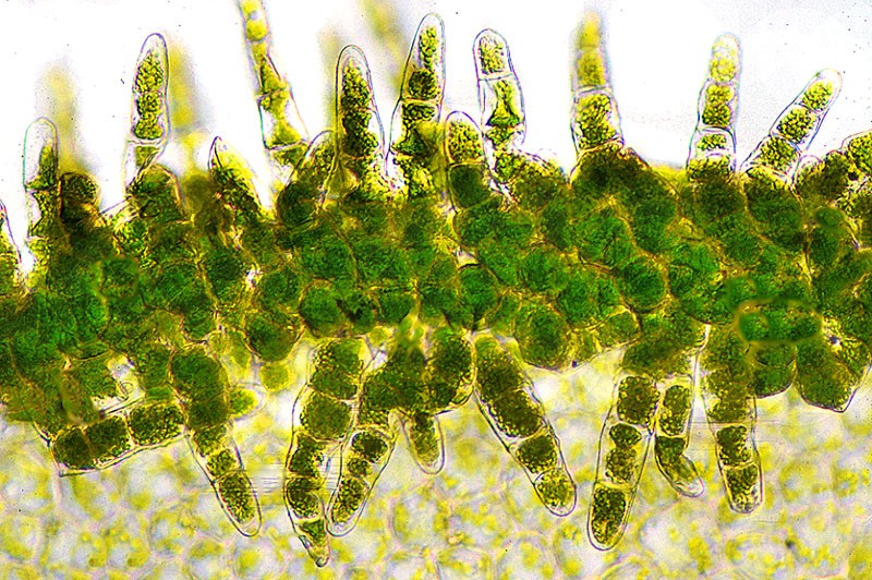 Detail of leaf margin with brood bodies