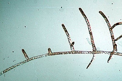 protonema_1-400 protonema_1-400