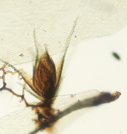 Dwaf male, cleared specimen