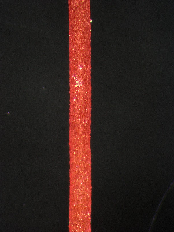 Sporophyte seta (stem) with raised papillae Sporophyte seta (stem) with raised papillae